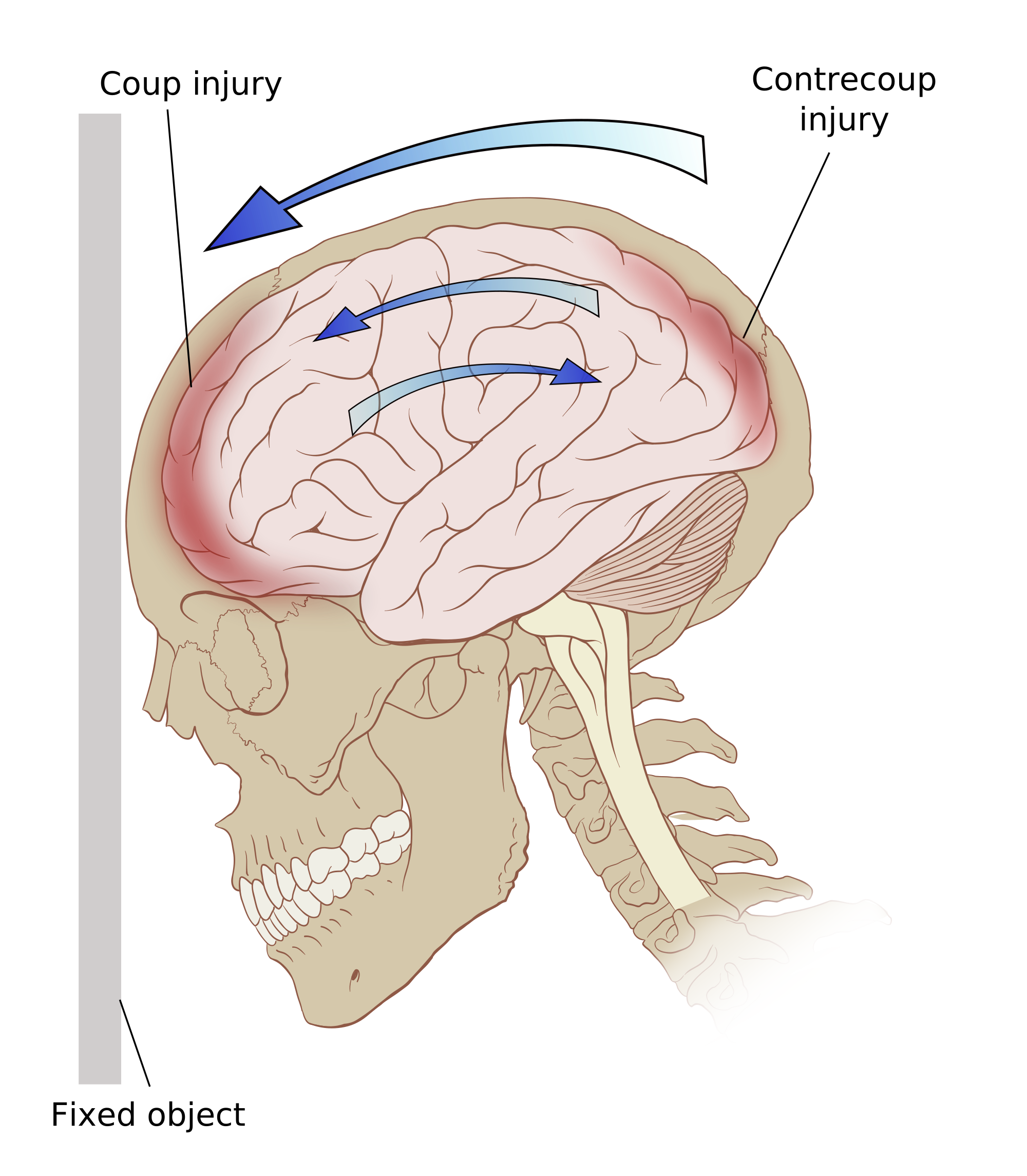 how-long-can-a-seizure-last-before-brain-damage-knowyourbrain